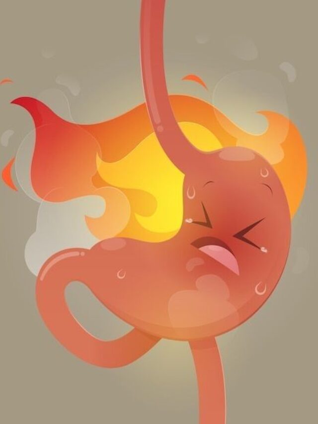 Acidity meaning in Hindi