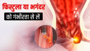 fistula meaning in hindi