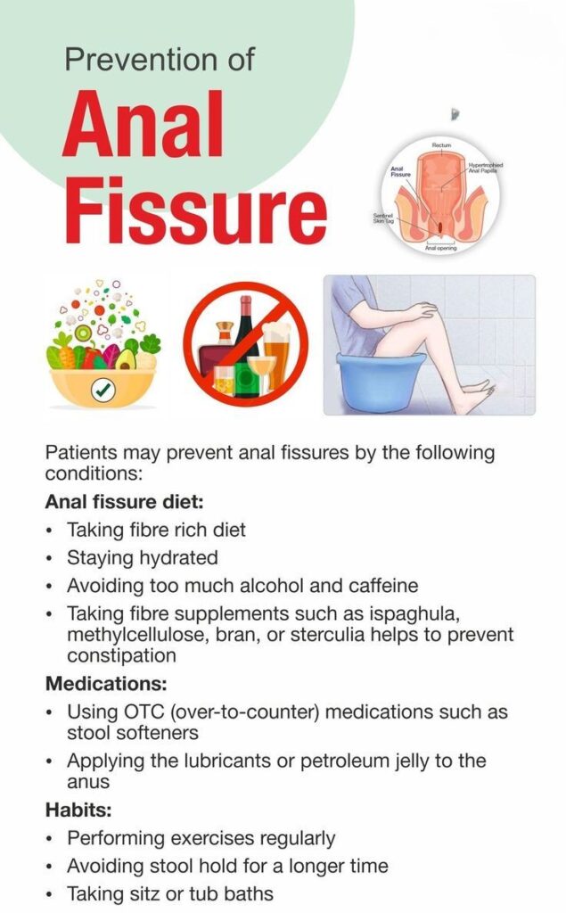 Fissure