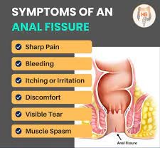 Fissure meaning in hindi