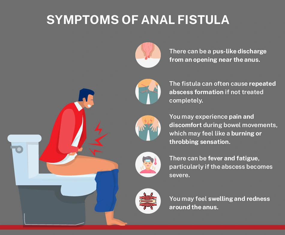 fistula kya hota hai