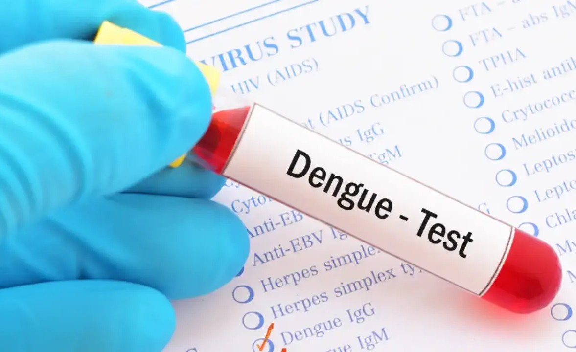 Dengue test