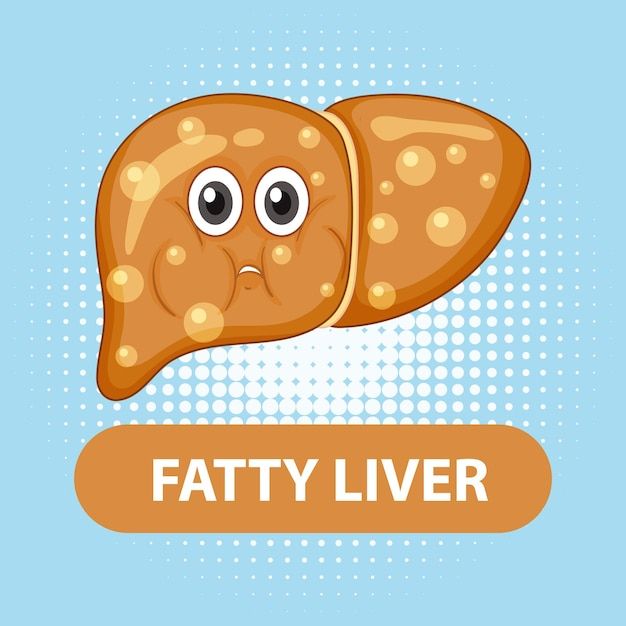 Grade 1 fatty liver